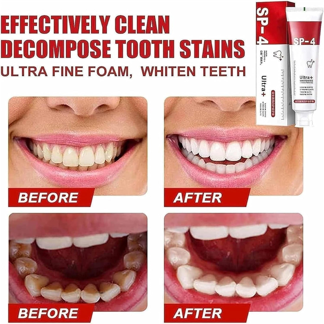 Yayashi SP4 Oral Care Probiotic Whitening Toothpaste 120g – Shine Brighter, Remove Years of Coffee, Tea & Smoking Stains