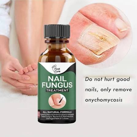 Day Nail Fungal Treatment Serum Foot Toe Nail Fungus Removal