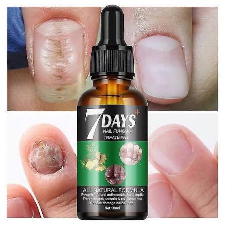 Day Nail Fungal Treatment Serum Foot Toe Nail Fungus Removal