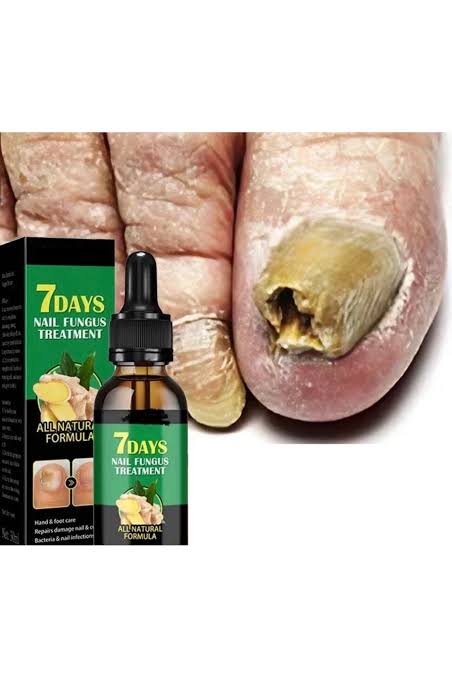 Day Nail Fungal Treatment Serum Foot Toe Nail Fungus Removal