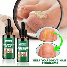 Day Nail Fungal Treatment Serum Foot Toe Nail Fungus Removal